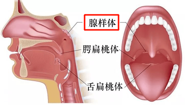 女子上厕所闻到恶臭，当晚扁桃体发炎，一次意外的健康警报